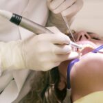Questions You’re Too Shy to Ask the Dentist